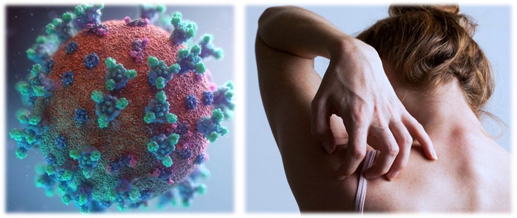 Δερματικά εξανθήματα και COVID-19