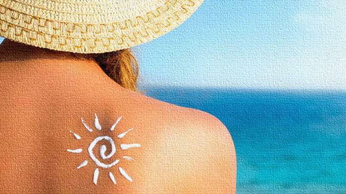 Sunburn1